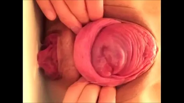 japanese prolapse Ống mới