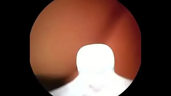 Nyt Camera in fertile cervix frisk rør